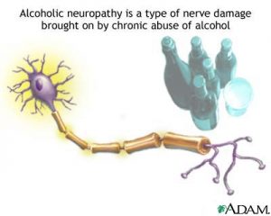 Neuropathy Cures Neuropathy Cures
