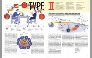 Information on type II diabetes Information on type II diabetes