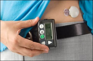 continuous blood glucose monitoring continuous blood glucose monitoring
