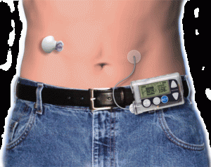 diabetic insulin pumps diabetic insulin pumps