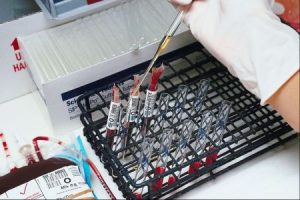 fasting blood sugar level fasting blood sugar level